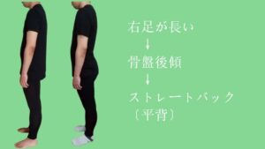 ストレートバック(平背)の原因は脚長差|右脚長1,5cm→ほぼ同長へ